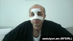 Айк Ханумян  в больнице Степанакерта, 7 июля 2016 г․