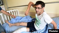 Еревандағы шеруде жараланған видео оператор. 30 шілде 2016 жыл